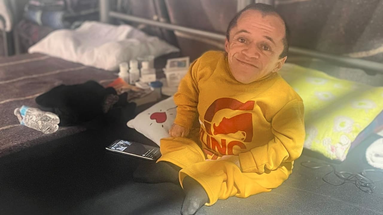 Marco Alejandro, de 35 años, padece de osteogénesis imperfecta, conocida como “huesos de cristal”.