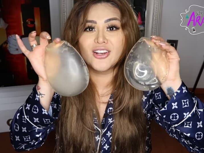 Gomita se quitó los implantes de los glúteos por salud.