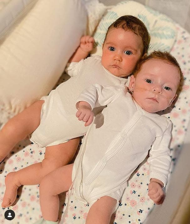 En mayo comenzó a publicar fotos donde aparecía con las mellizas y se apreciaba que
<b> una de ellas utilizaba oxígeno.</b>
<br>