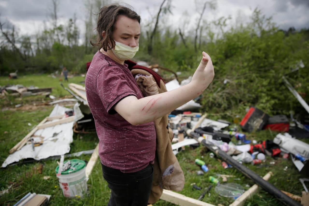 Michael Berhm, de 16 años, muestra las heridas que le causó un tornado a su paso por Chatsworth. El clima severo se extendió por el sur y dañó cientos de hogares desde Louisiana hasta los Montes Apalaches.