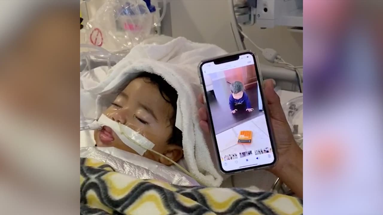 Bebé Nick se mantiene conectado a un respirador artificial después de sufrir un accidente que lo dejó inconsciente en su casa.