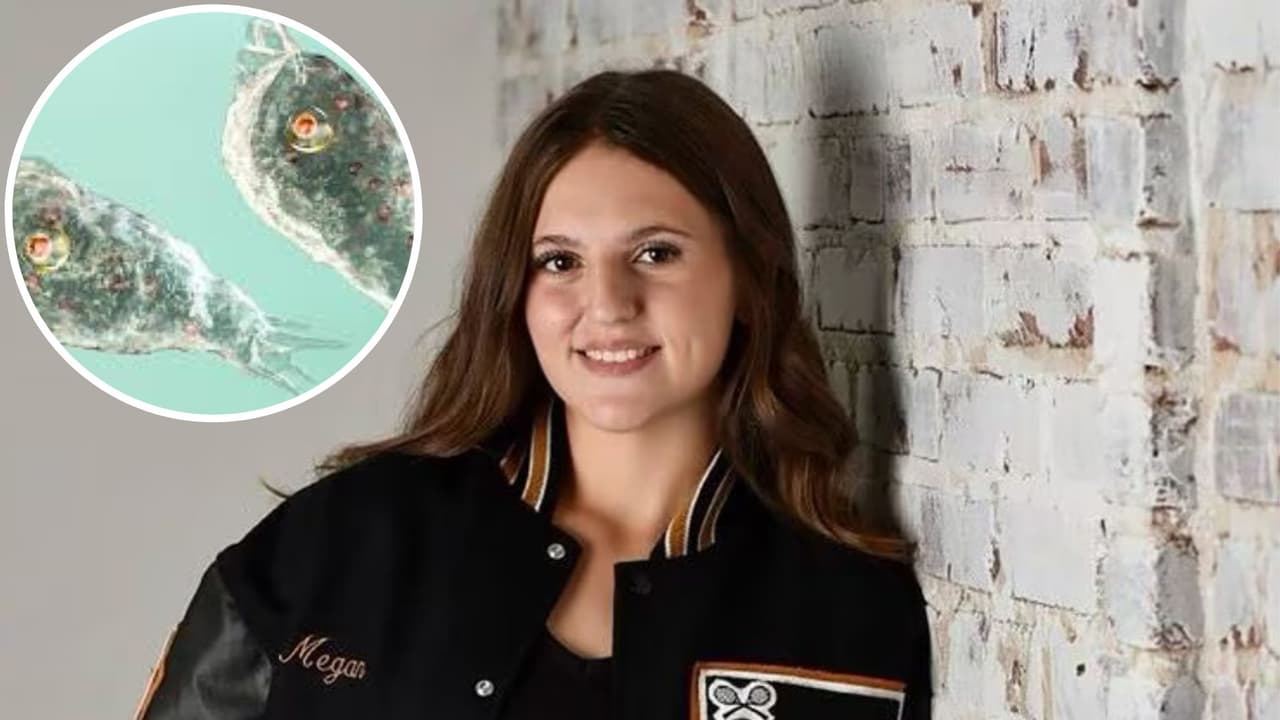 Adolescente de 17 años muere tras rara infección provocada por una ameba 'comecerebros'
