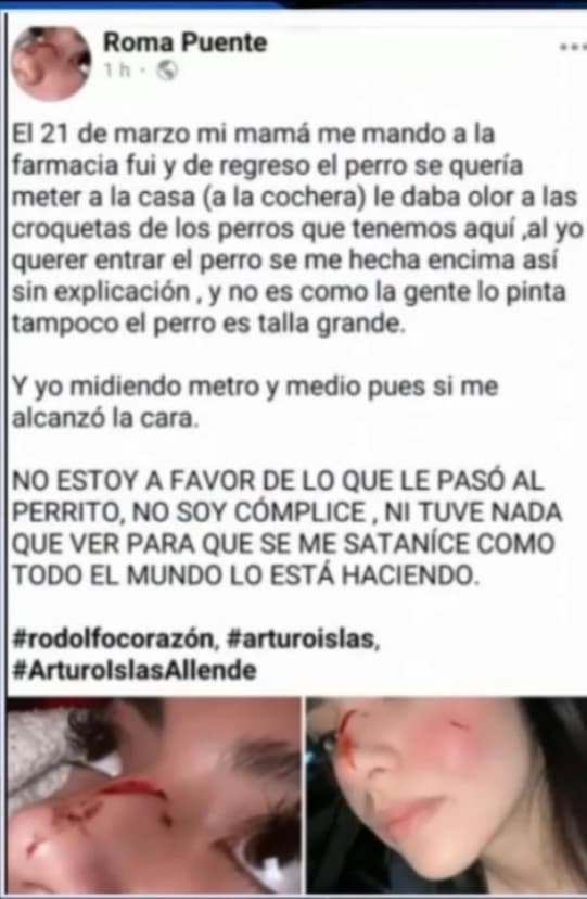 Al ver la reacción furibunda de la gente, Adriana decidió justificarse en redes sociales y aclaró que ella no había tenido nada que ver en la decisión de asesinar a Rodolfo e incluso
<b> mostró la cuenta de unos 400 dólares</b> que tuvo que pagar para curar sus heridas. 
<br>