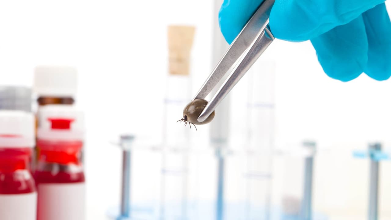 3. Los síntomas típicos al principio son fiebre, dolor de cabeza, dolor de cuello dependiendo de qué tejidos neurales estén infectados y también vómitos.