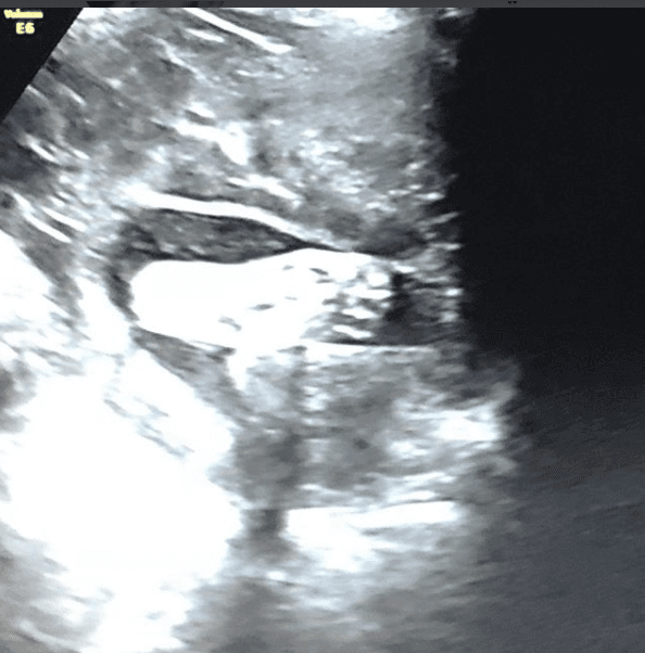 En abril pasado fue el cumpleaños de Kimberly Flores y uno de los regalos que recibió de parte de Edwin fue el nuevo ultrasonido de la bebé Gianna, quien en esta ocasión solo dejó ver uno de sus piecitos.