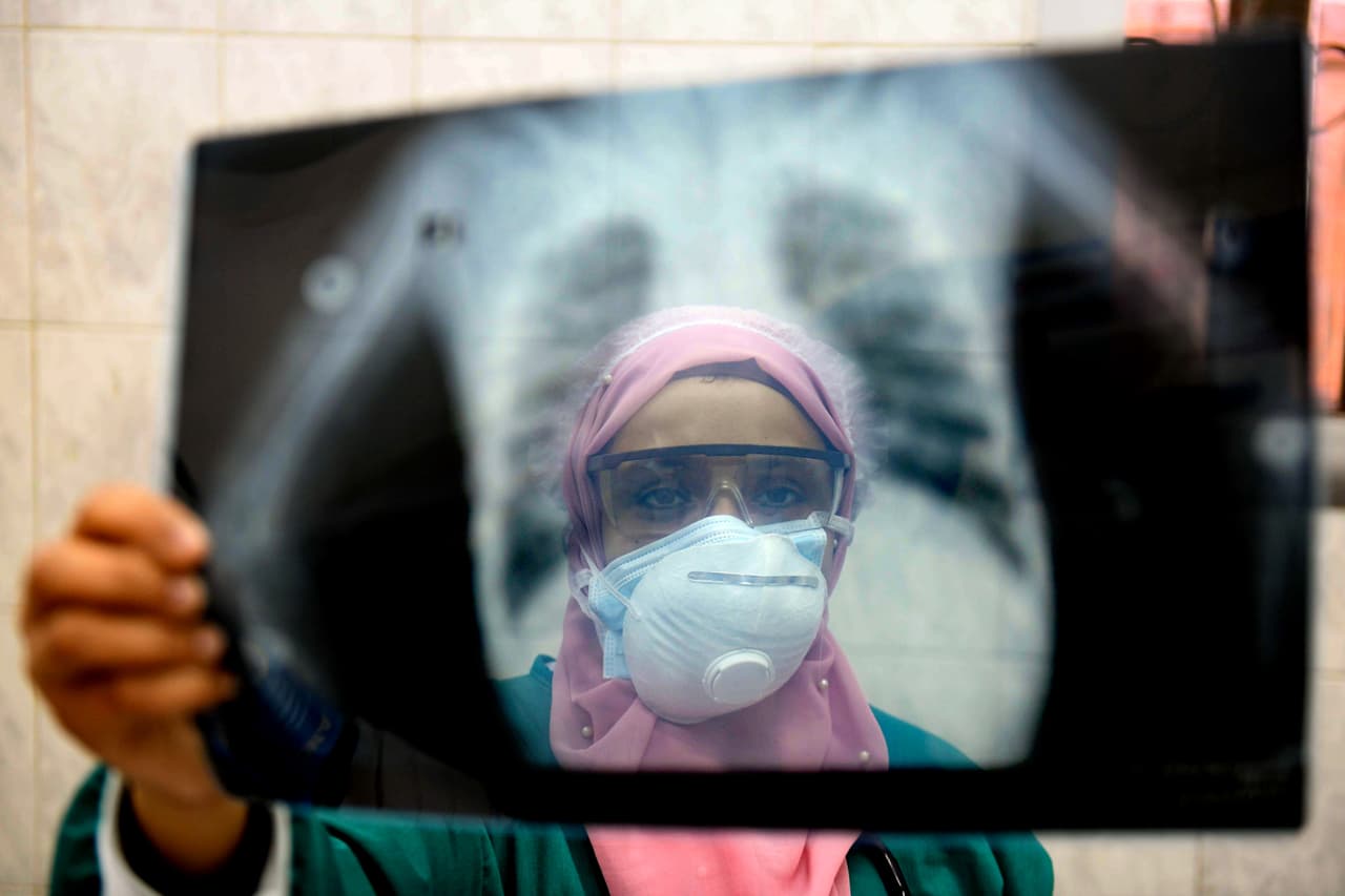 <b>Egipto: 159 trabajadores de la salud muertos por covid-19.</b> El análisis de Amnistía Internacional, publicado el 3 de septiembre, encontró que más de 7,000 empleados sanitarios fallecieron a consecuencia de la enfermedad. En la fotografía una médica egipcia analizando una radiografía de los pulmones de un paciente infectado con el coronavirus en El Cairo, en abril. 
<a href="https://www.univision.com/noticias/salud/mapa-actualizado-del-coronavirus-cifras-de-casos-confirmados-y-fallecidos"><u>Vea aquí nuestro mapa actualizado del coronavirus: cifras de casos reportados, fallecidos y recuperados</u></a>
<br>