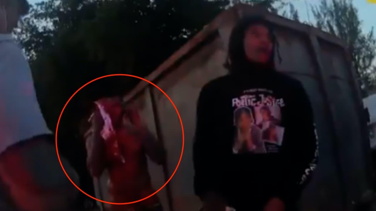 Jugador de la NBA lesionado afuera de un club nudista de Miami