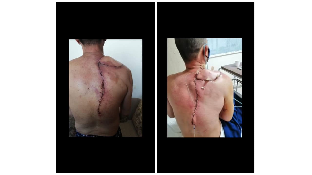 Así documentaba su lucha contra el cáncer.