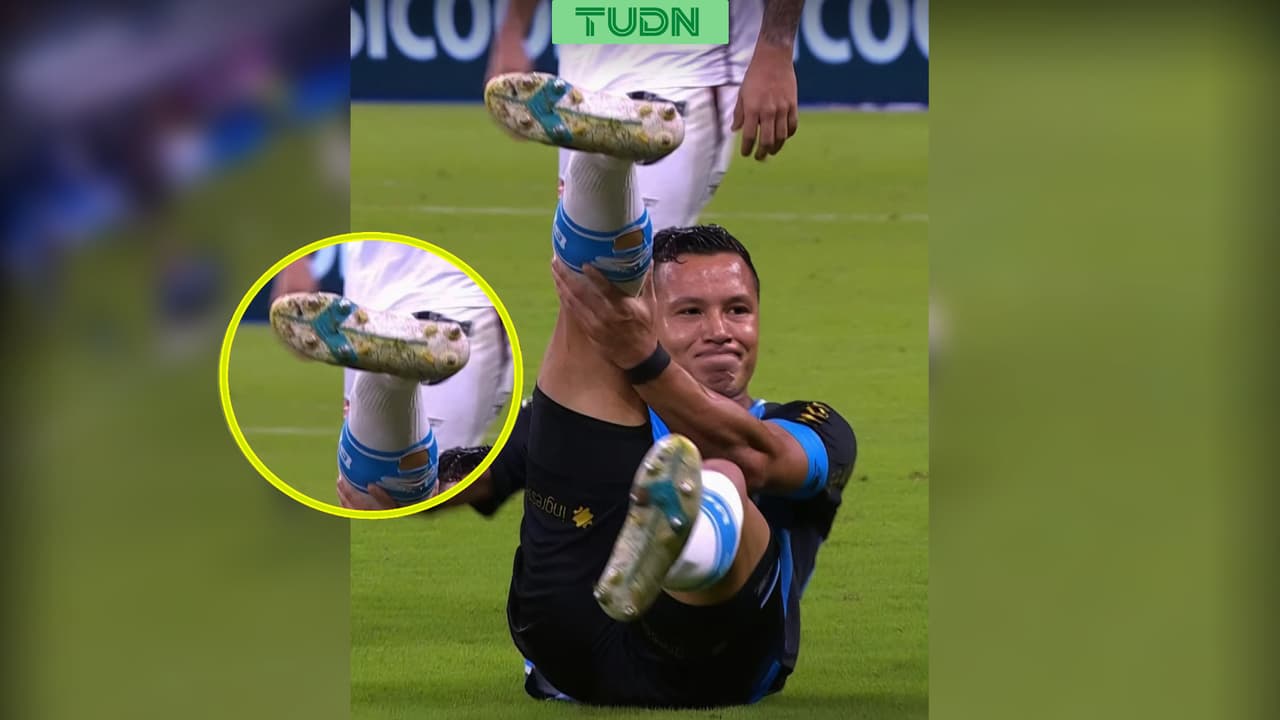 Escalofriante fractura de un jugador del Gremio en el Brasileirao