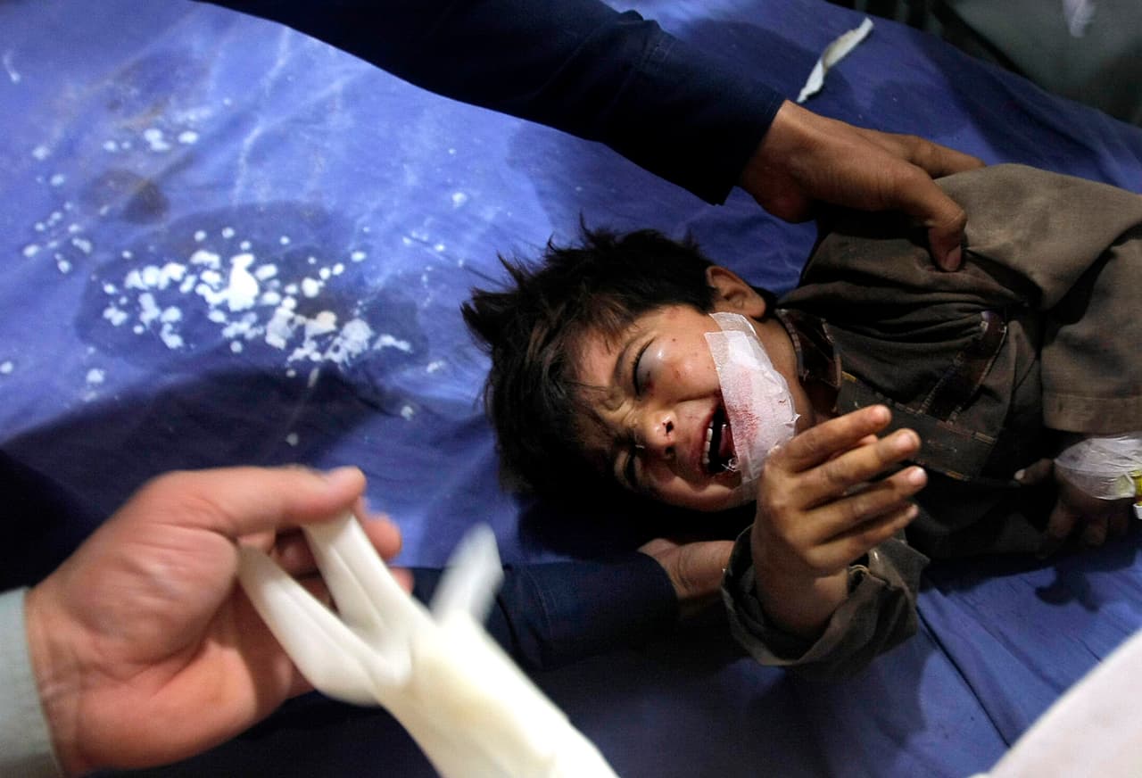 Un doctor trata a un niño en Peshawar (Pakistán).