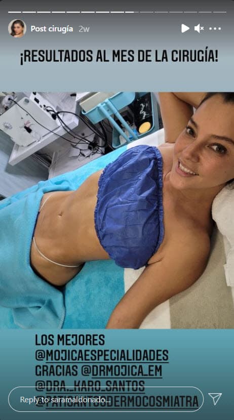 Ahora es su médico cirujano quien detalla las partes del cuerpo de la actriz que fueron intervenidas: "Lo que le realizamos a Sara Maldonado fue una
<b> lipoescultura en alta definición</b>", contó el doctor Rodolfo Pérez Mojica al programa 'Ventaneando'.
<br>