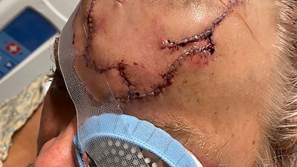 10 segundos de pánico: así sobrevivió un hombre a un ataque de oso