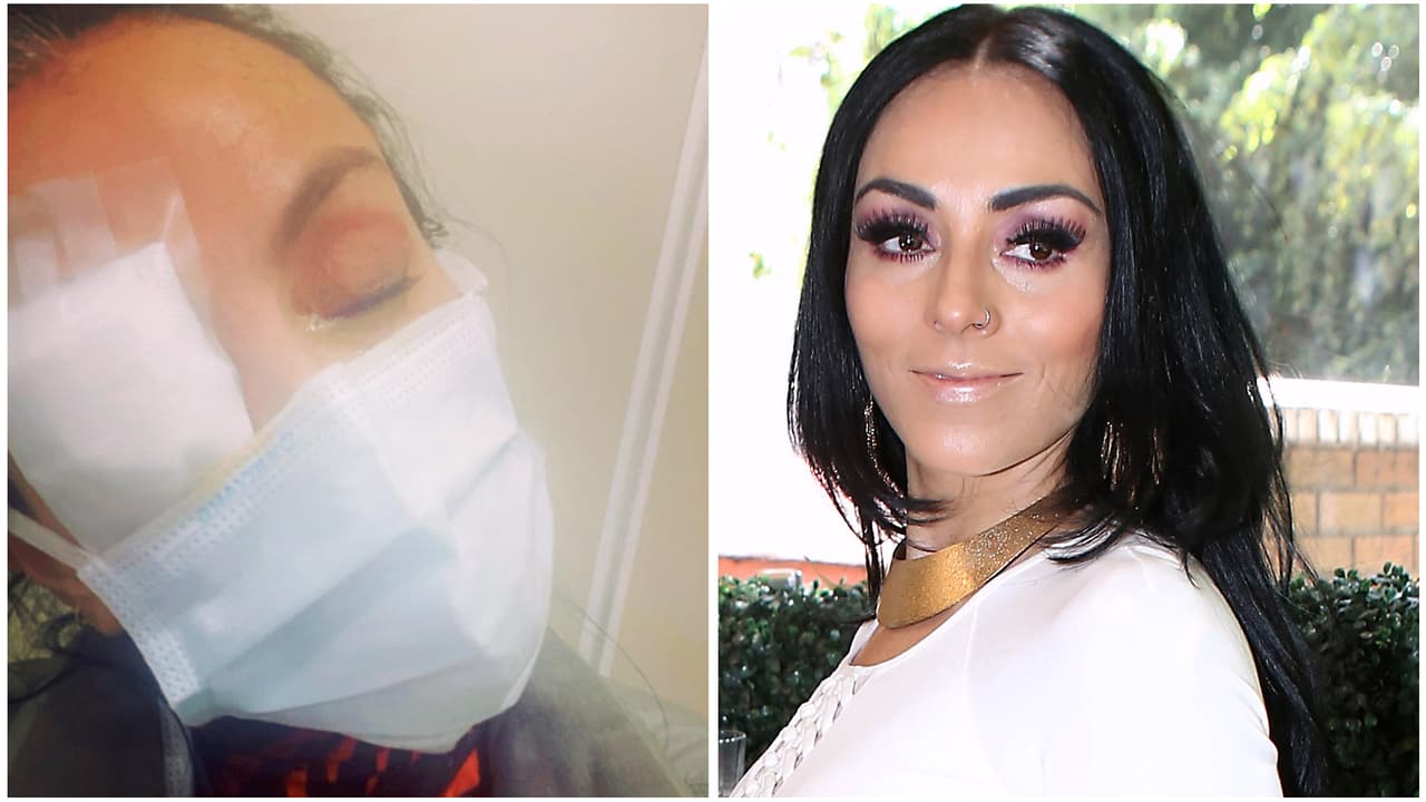 "Ganas de arrancarme los ojos": Ivonne Montero relata cómo se quemó las córneas