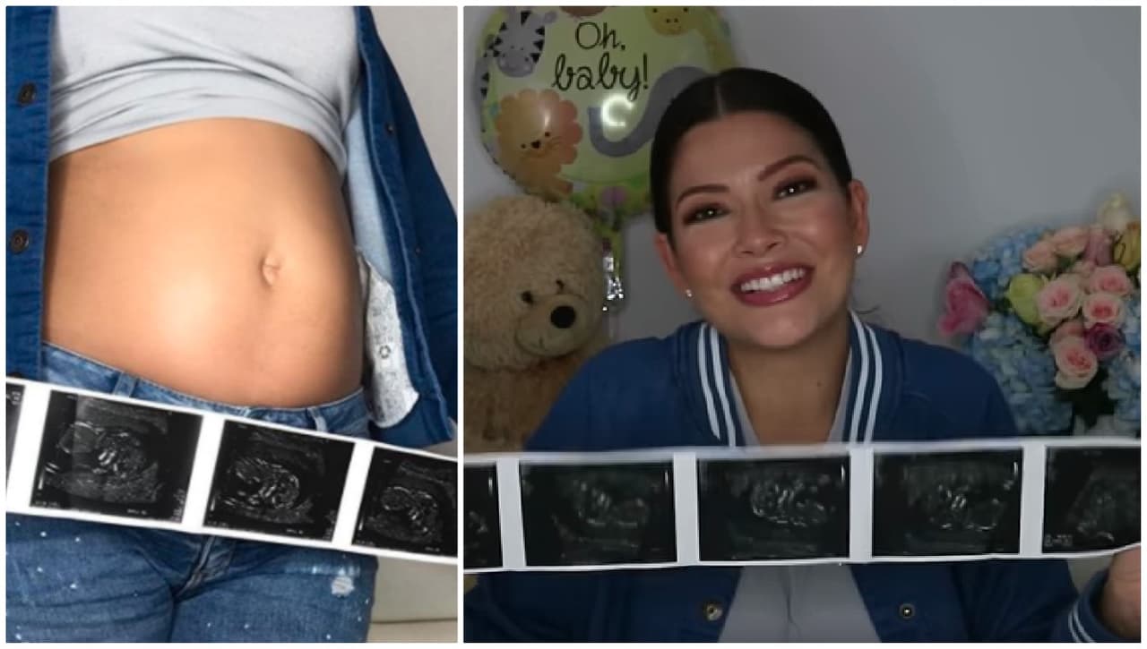 Con la mirada bañada en lágrimas Ana Patricia muestra el cuerpo del bebé que lleva en su vientre