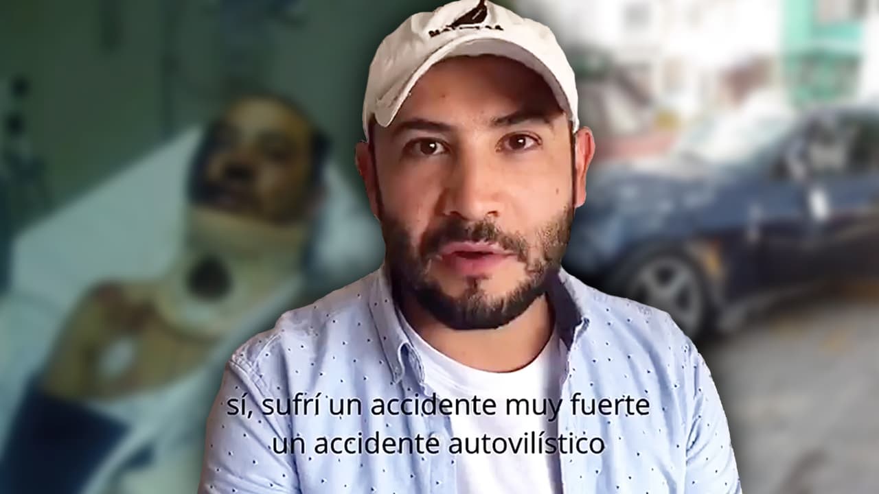 Actor infantil de ‘Amigos x siempre’ muestra fotos del accidente que lo alejó de la actuación