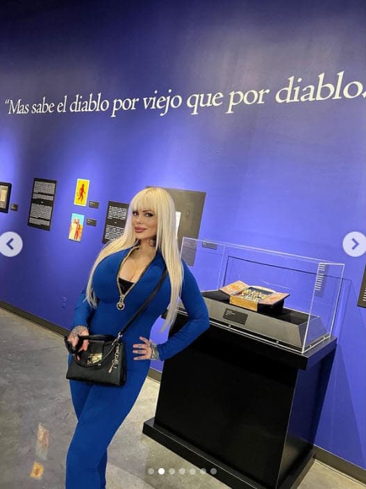 "Algo me tocó los nervios que no puedo mover la cara", lamentó. 
<br>