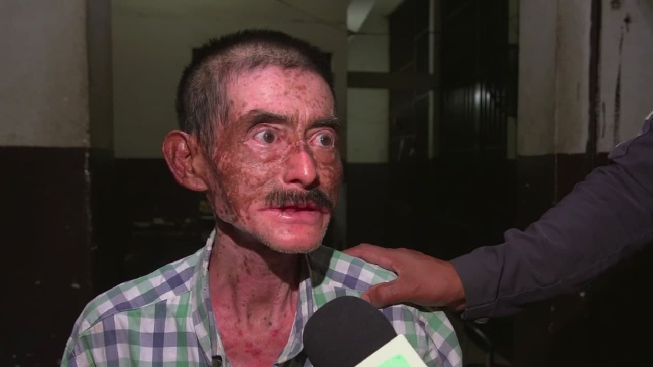 Horror en Guatemala: Arrestan a padre por abrir vientre de su hija para extraerle un bebé alegando que tenía un demonio