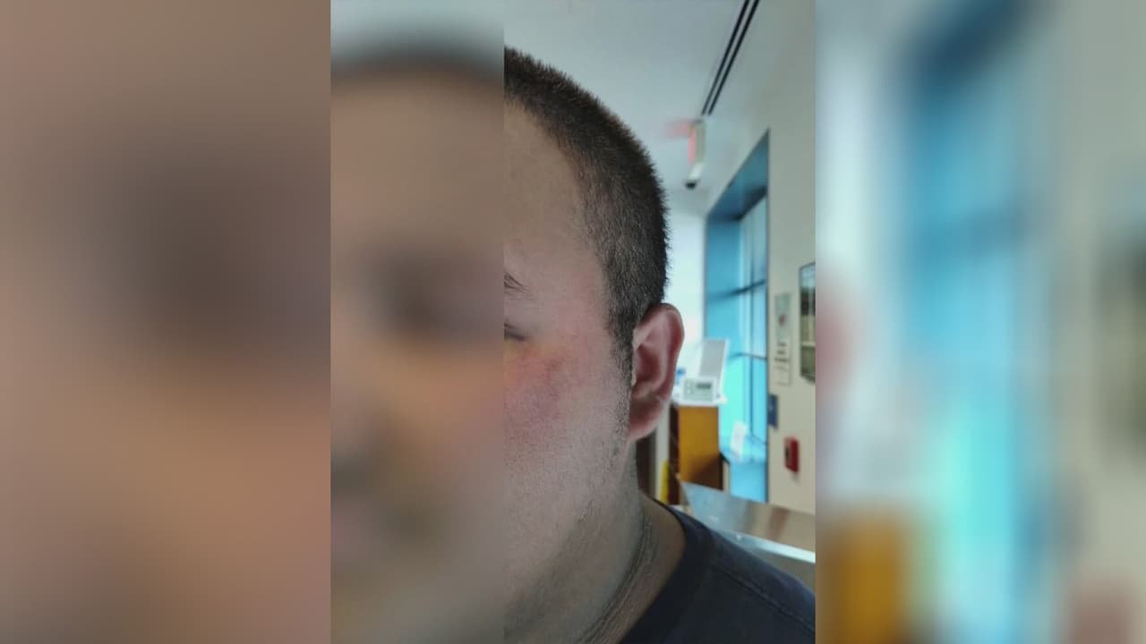 "Lo aventó del segundo piso": denuncian ataques y amenazas de muerte a un joven hispano en Silver Spring