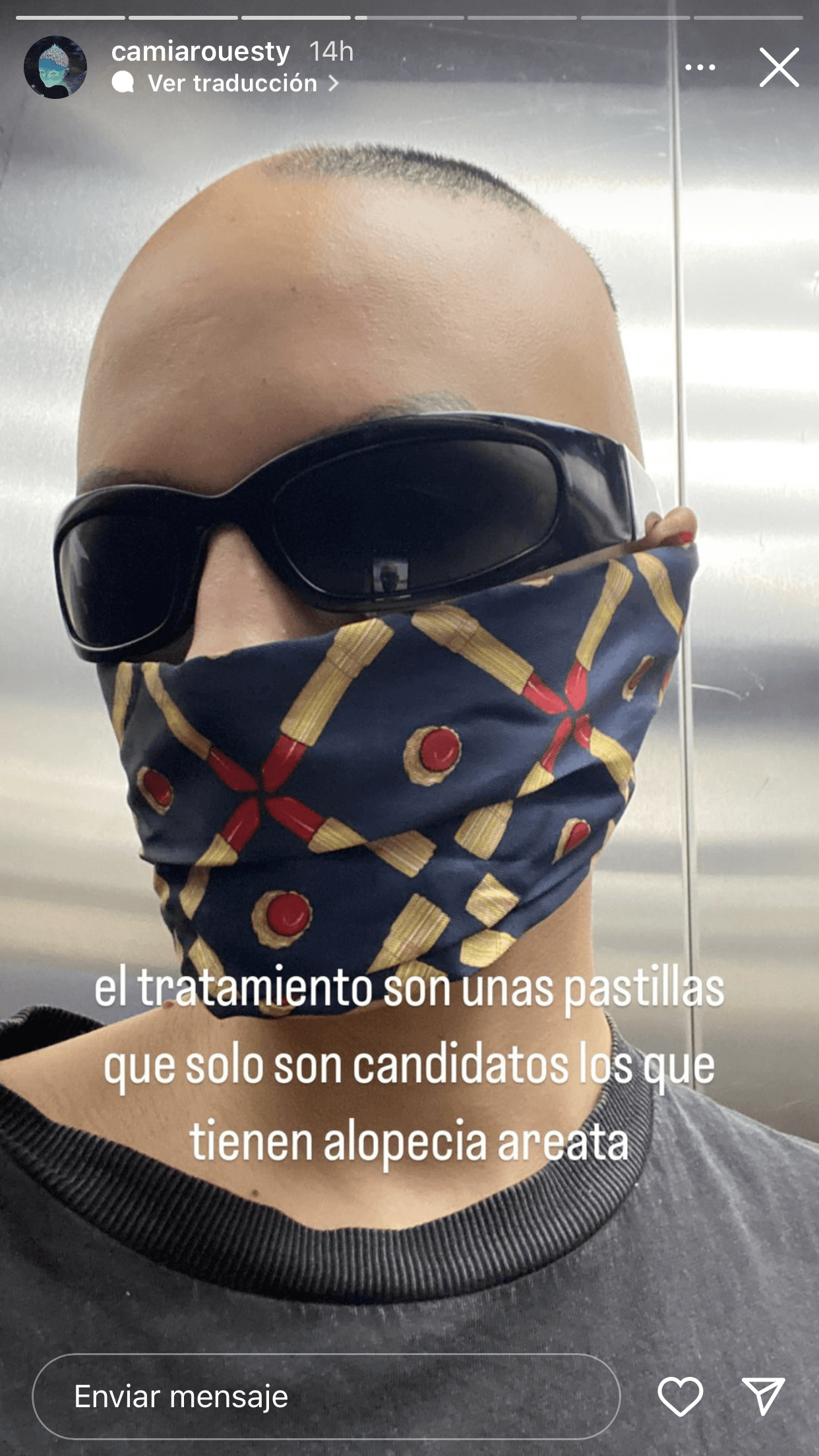 "El tratamiento son unas pastillas que solo son candidatos los que tienen alopecia areata", explicó Solórzano.