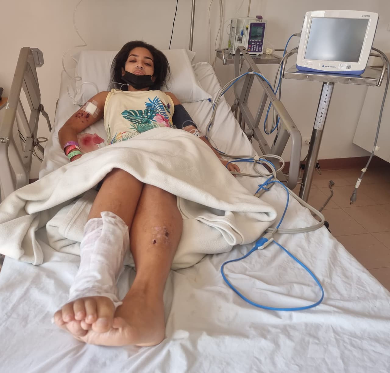 Si deseas ayudar a la joven panameña a salvar su pierna y dejar de preocuparse por su salud tras la negligencia médica que sufrió, 
<a href="https://www.gofundme.com/f/ayudemos-a-maybeth-a-recuperar-su-salud?utm_campaign=p_cp+share-sheet&utm_medium=copy_link_all&utm_source=customer" target="_blank">esta cuenta de GoFundMe</a> fue abierta por la familia para recibir sus donaciones o se pueden comunicar directamente vía Whatsapp al +507-6786-6522 o llamar al +507-6328-6716.
<br>