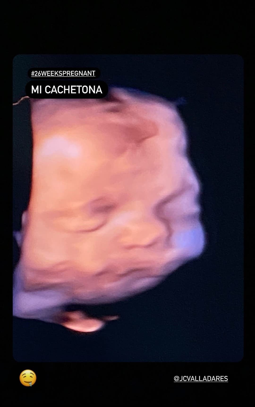 Ahora que está viviendo un embarazo sin complicaciones y que en las últimas semanas pudo conocer a la nena que crece en su vientre, Ximena recordó los sentimientos que la invadieron mientras se sometía al tratamiento: "Yo cuando me hacía extracciones decía: '¿Será que sí lo voy a conseguir, será que no? Gracias a Dios sí se pudo".