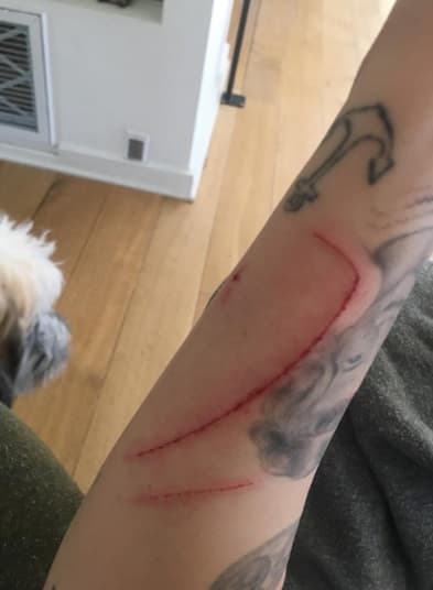 Así le quedó el brazo a Miley, luego de que el minino se fuera contra ella. Se sabe que la cantante tiene cuatro gatos, pero no especificó quien de ellos fue el responsable de este percance.