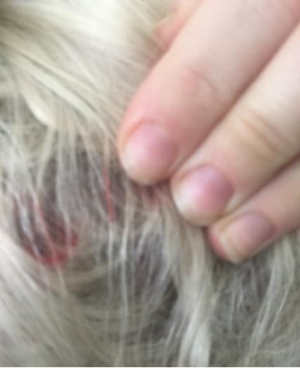 Hasta en la cabeza tiene heridas, ¿qué habrá pasado? Se nota que la batalla estuvo fuerte, pues para que el gato la atacar tuvo que haber ocurrido algo grave.