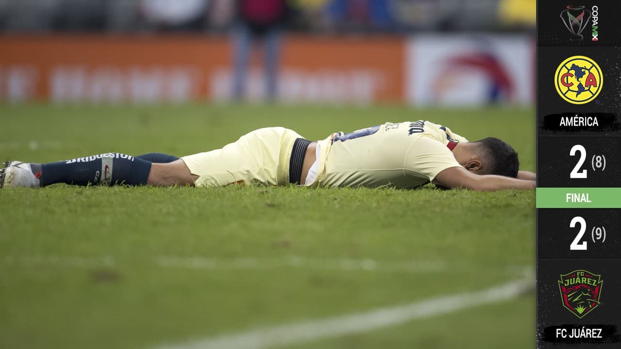 América se despide de la Copa MX.