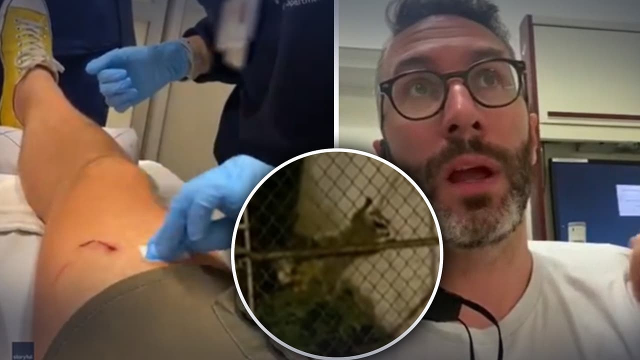 Mapache ataca a hombre en Filadelfia; todo queda en video