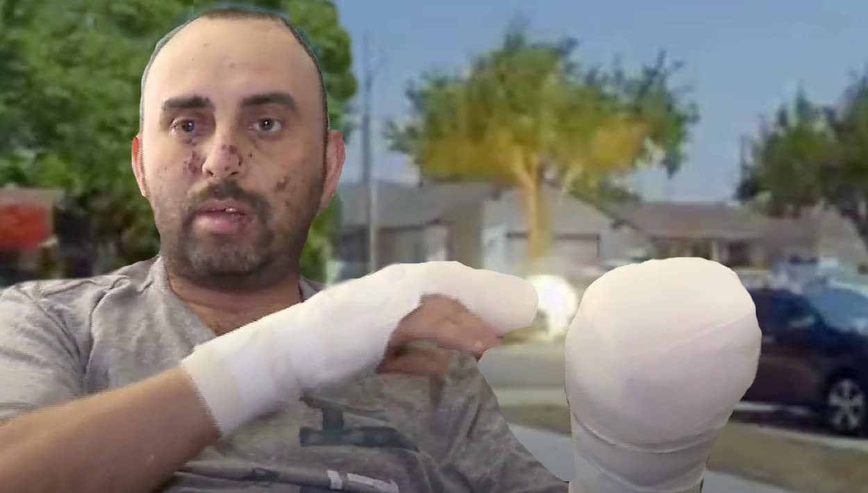 Jardinero hispano recoge una "bolita" en Torrance y en el acto pierde dedos, dientes y visión