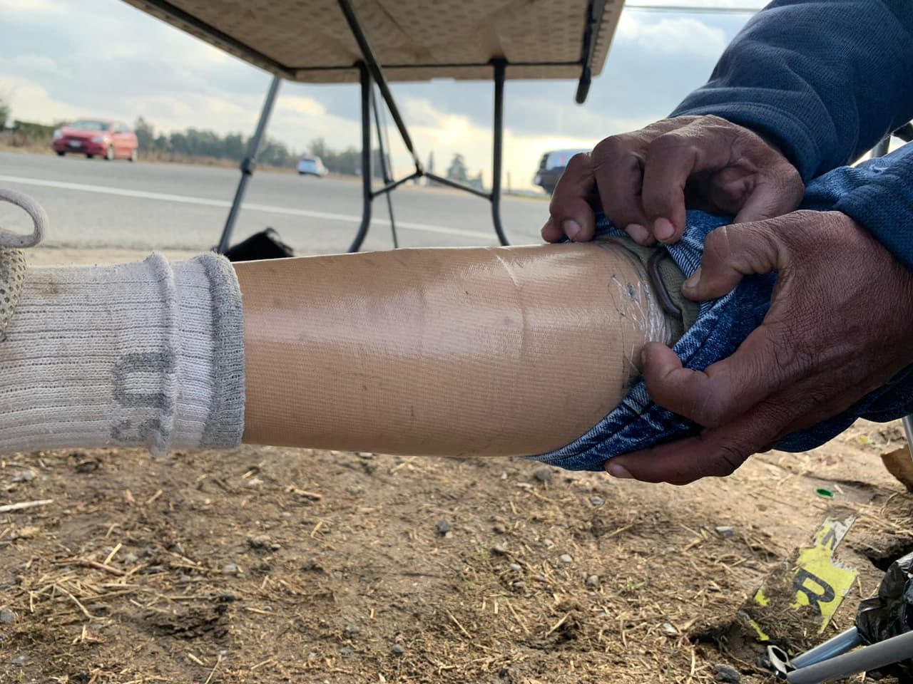 Guillermo Lozano busca dinero para una nueva prótesis