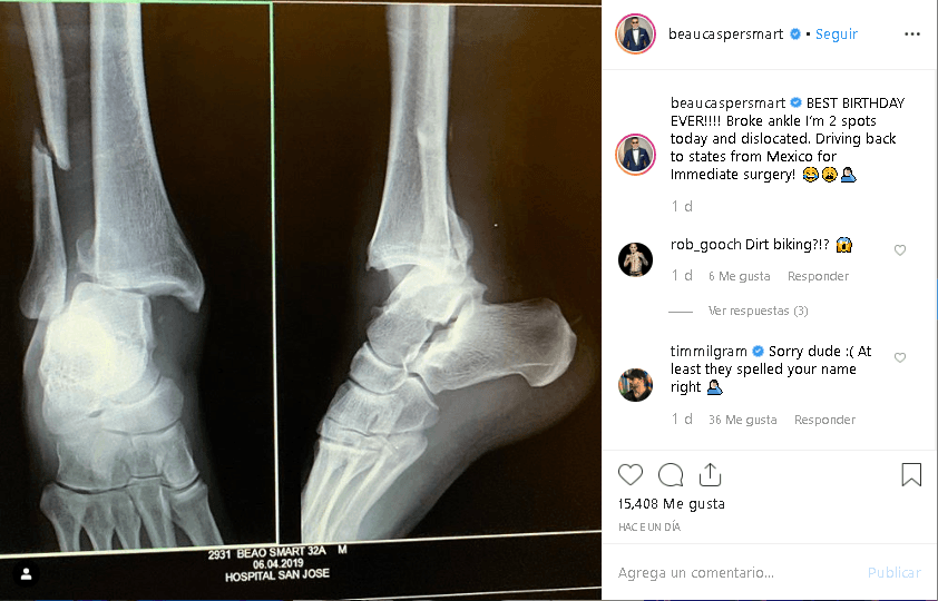 “¡El mejor cumpleaños de todos! Me rompí y disloqué el tobillo”, ironizó el coreógrafo.