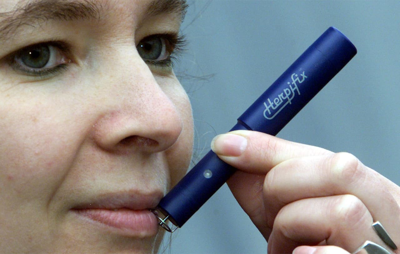 <b>Herpes bucal:</b>
<br>De acurdo con la biblioteca Nacional de Medicina de EE.UU. es una infección que puede desarrollar llagas dolorosas y desagradables en los labios y sus alrededores. En algunos casos está relacionado con el herpes vaginal y se puede transmitir a través de un beso o sexo oral.