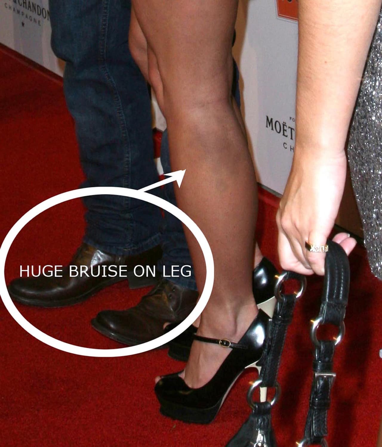 ¿Te acuerdas de sus indiscreciones y cómo se le veía muy maltratada?