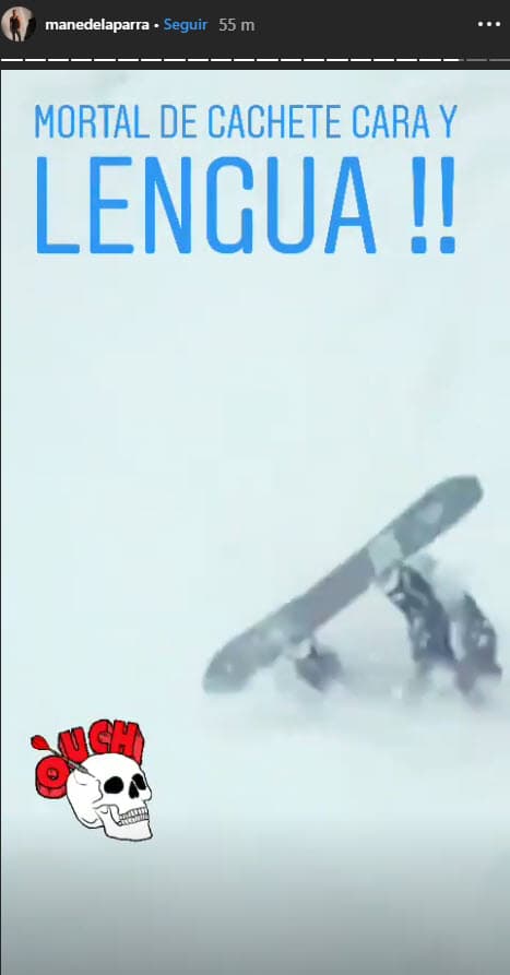 Sin embargo, uno de los tres actores tuvo un accidente cuando se deslizaba en la nieve.