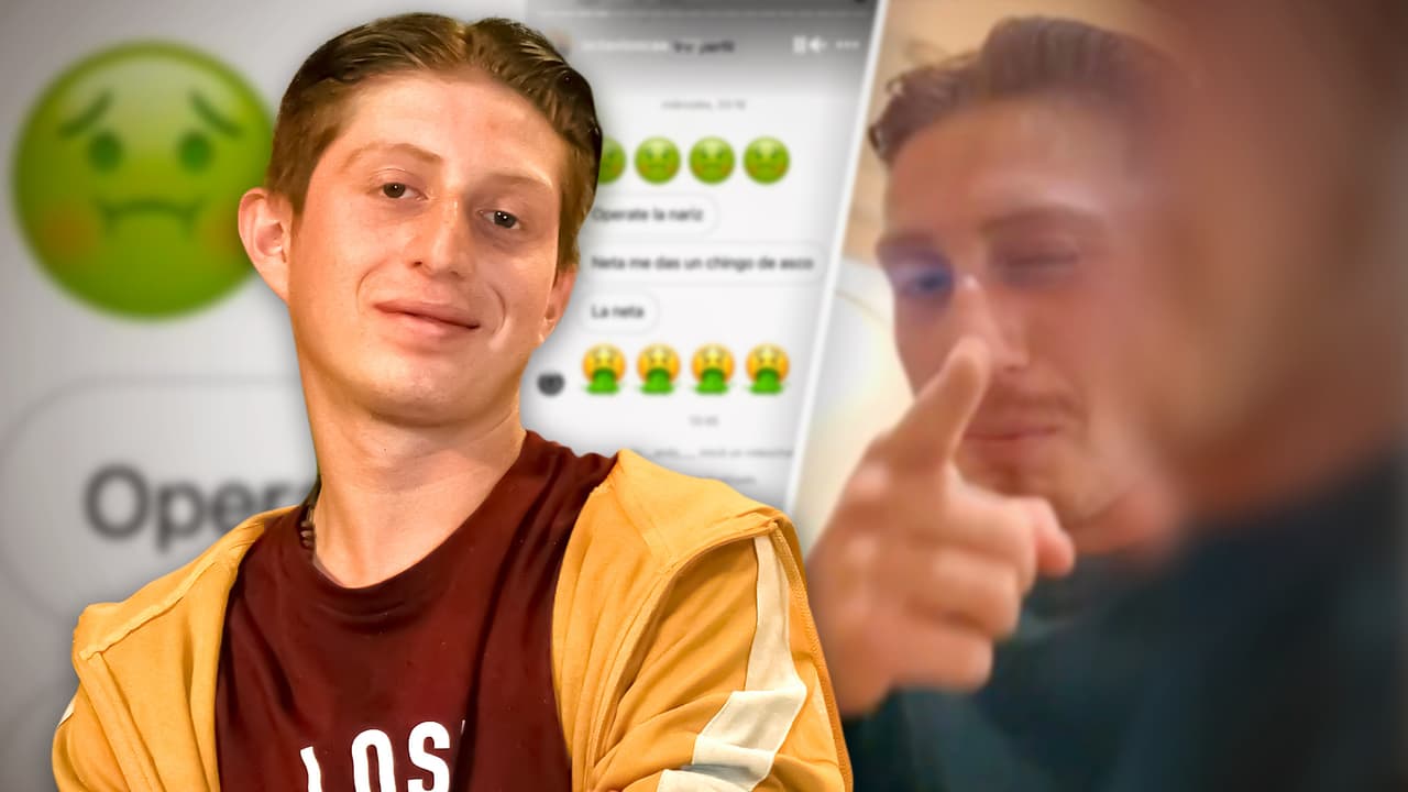 "Todos tenemos un espejo": Benito de Vecinos manda mensaje contundente a quienes critican su nariz