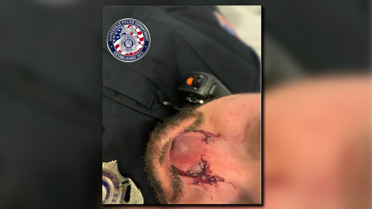Un policía de Georgia resultó herido tras ser mordido en la nariz por un sospechoso durante detención