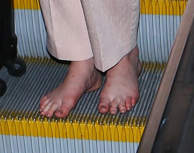 Afortunadamemnte llevaba las uñas bien pintaditas.