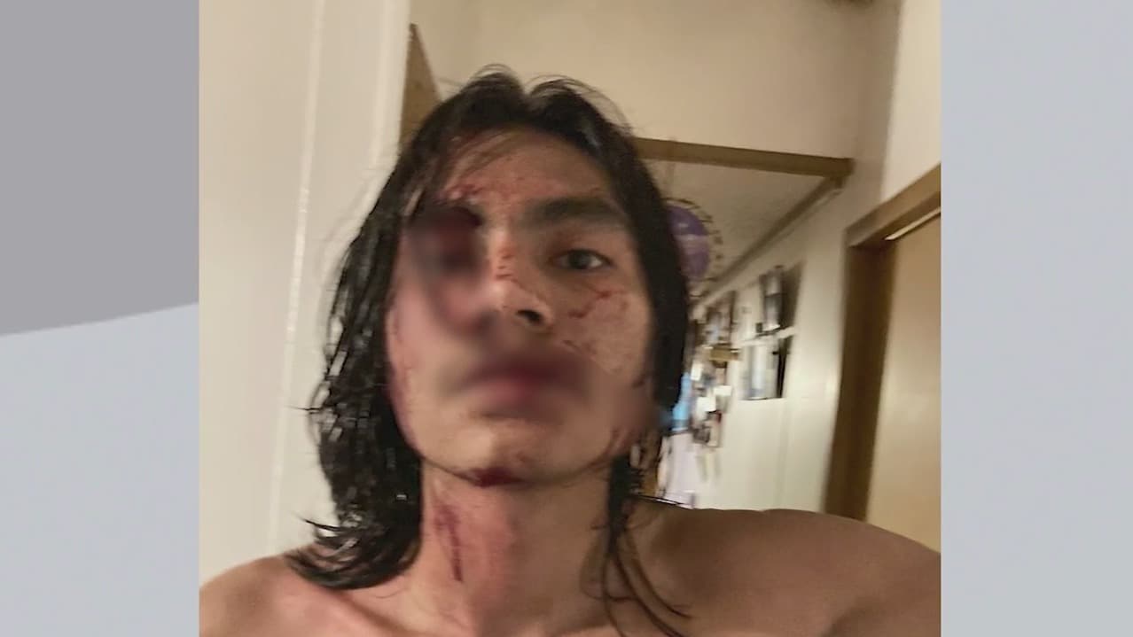 Madre de familia en San Antonio llegará hasta las últimas consecuencias contra los agresores de su hijo adolescente