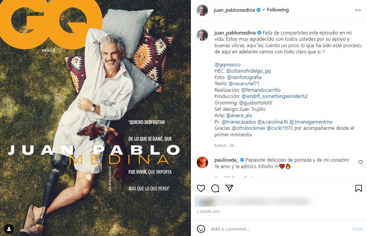 Juan Pablo Medina muestra por primera vez su prótesis en la revista GQ México.