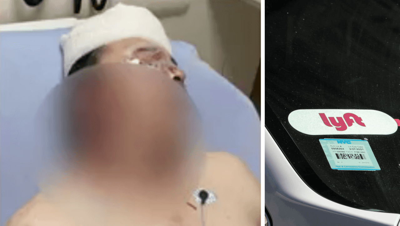 A punto de perder un ojo: familia de chofer de Lyft atacado por pasajeros exige justicia