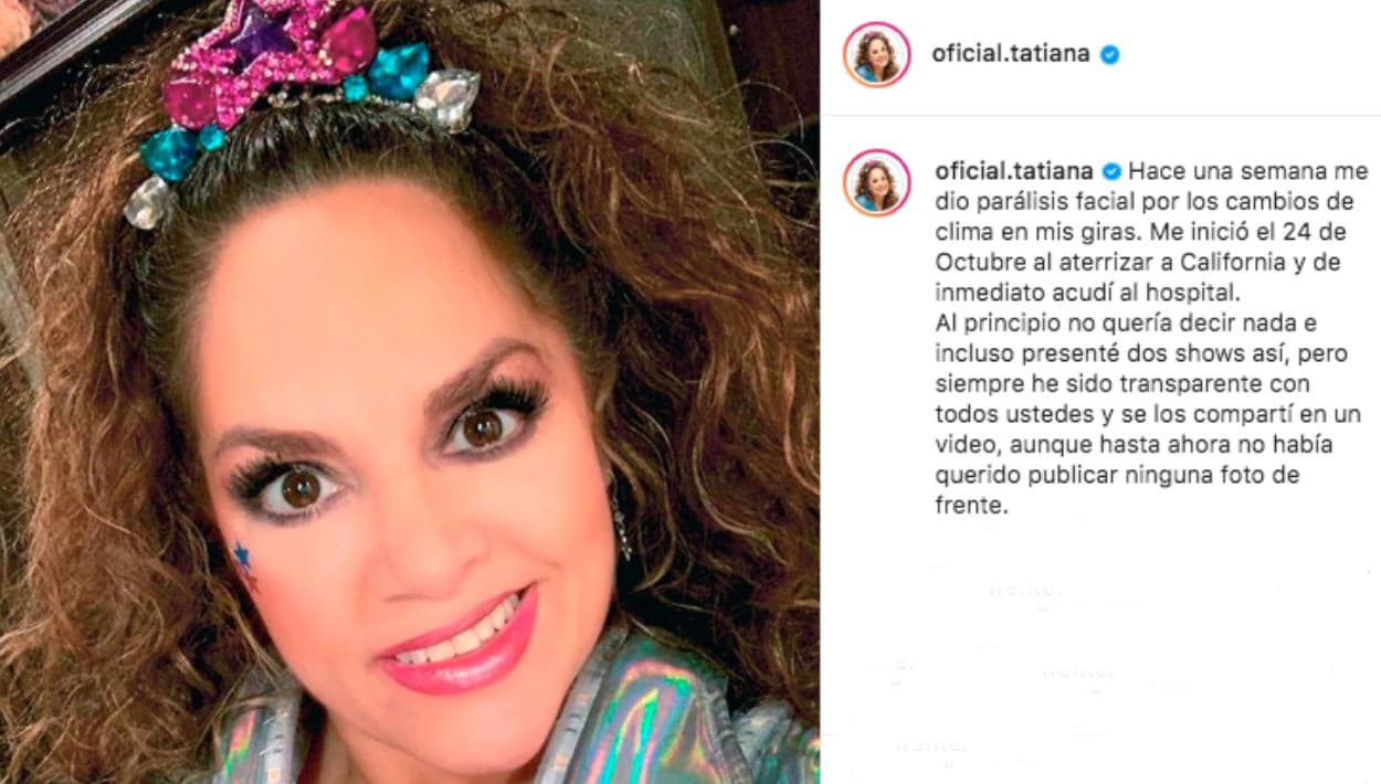 "Al principio 
<b><a href="https://www.univision.com/shows/el-gordo-y-la-flaca/tatiana-la-reina-de-los-ninos-sufre-paralisis-facial-y-explica-a-que-se-debio-video" target="_blank">no quería decir nada</a></b> e incluso presenté dos shows así (con la parálisis), pero siempre he sido transparente con todos ustedes y se los compartí en un video, aunque hasta ahora no había querido publicar ninguna foto de frente", escribió en Instagram. Junto a su mensaje, publicó una 
<b><a href="https://www.instagram.com/p/B4bYT31p7_F/" target="_blank">primera foto</a></b> de cómo lucía hace una semana.