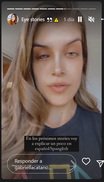 "Hasta el domingo 
<b>sí me estaba doliendo</b>", compartió, "pero en los próximos días se pondrá mejor". 
<br>