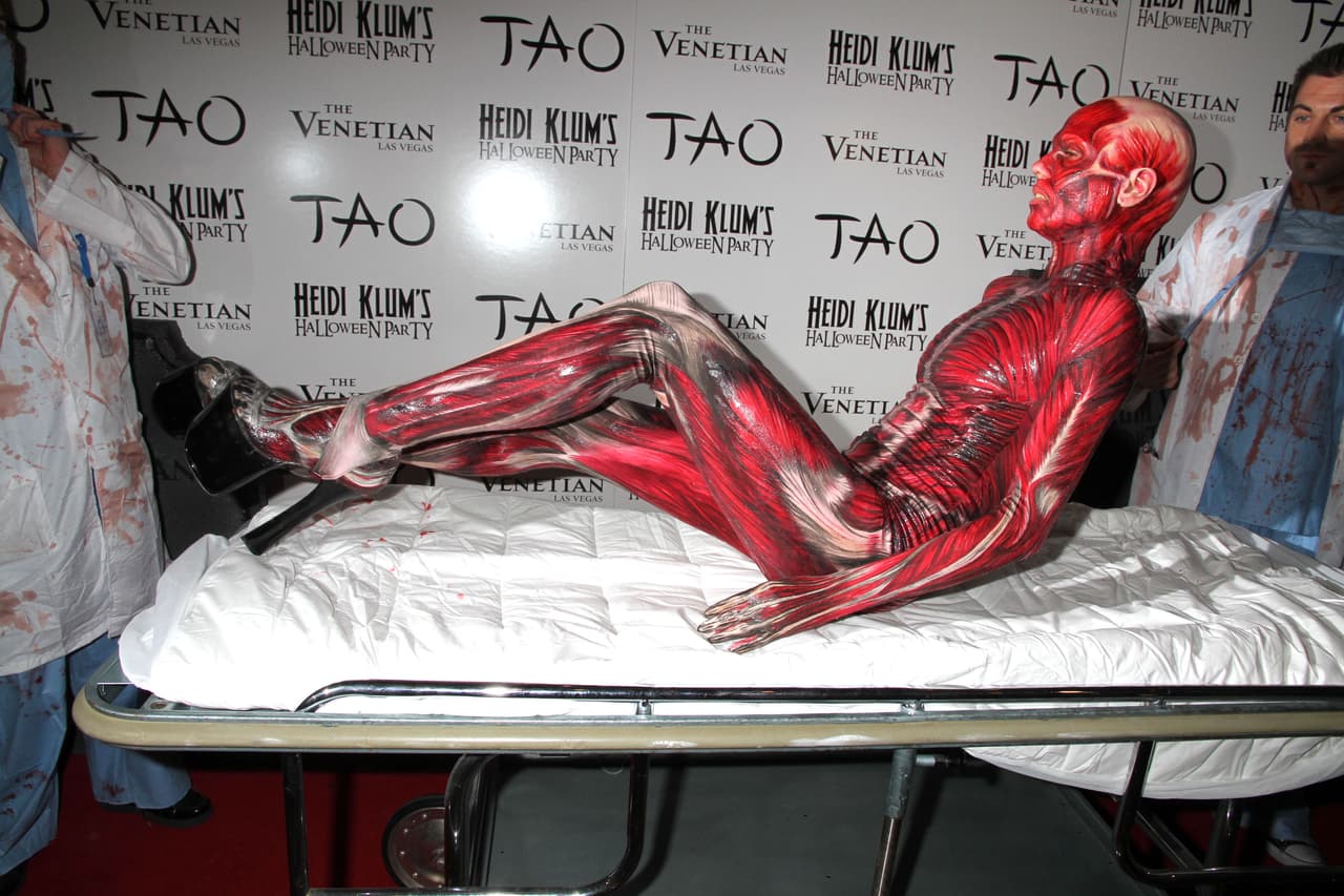 En 2011 en otra fiesta llegó en camilla.