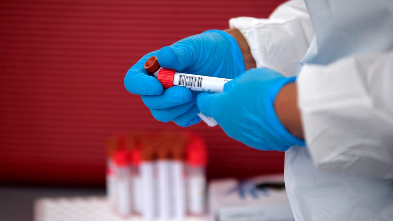 Quiénes son los que más sufrirán si se elimina Obamacare, como aspira el gobierno de Trump