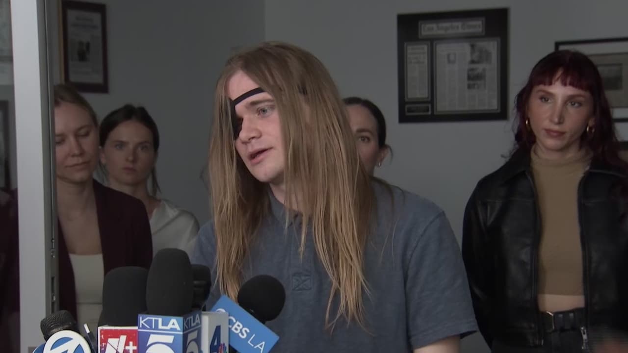 Estudiante de USC que perdió un ojo anuncia demanda contra DHS por proyectil en protesta