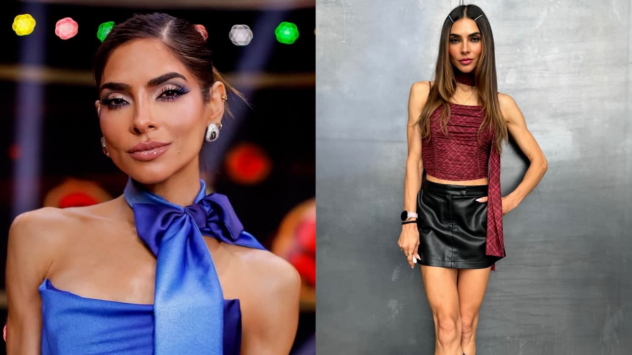 Ale Espinoza confiesa si le “afecta” que le digan que tiene un “desorden alimenticio”