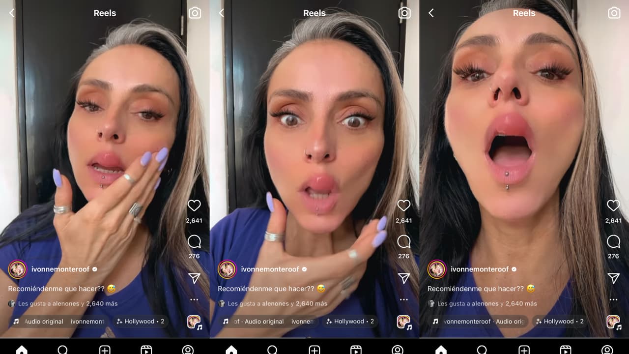 Ivonne Montero apareció con la parte superior del labio hinchado y desfigurado.