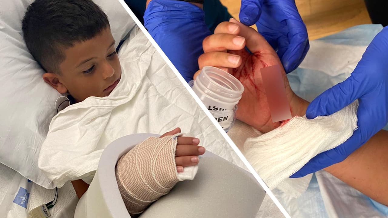 Tiburón ataca a un niño de 7 años en una playa de Fort Lauderdale 