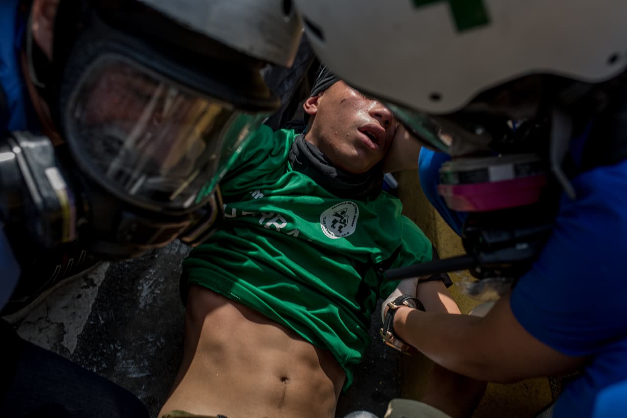 With gas masks but no bullet-proof vests, almost all of their equipment has been donated or purchased by volunteers. Anesthetics, antibiotics, anti-inflammatories, bronchodilators, sutures, gauze, eyedrops and antacids are the basic supplies they take to treat the injured on the streets during protests.